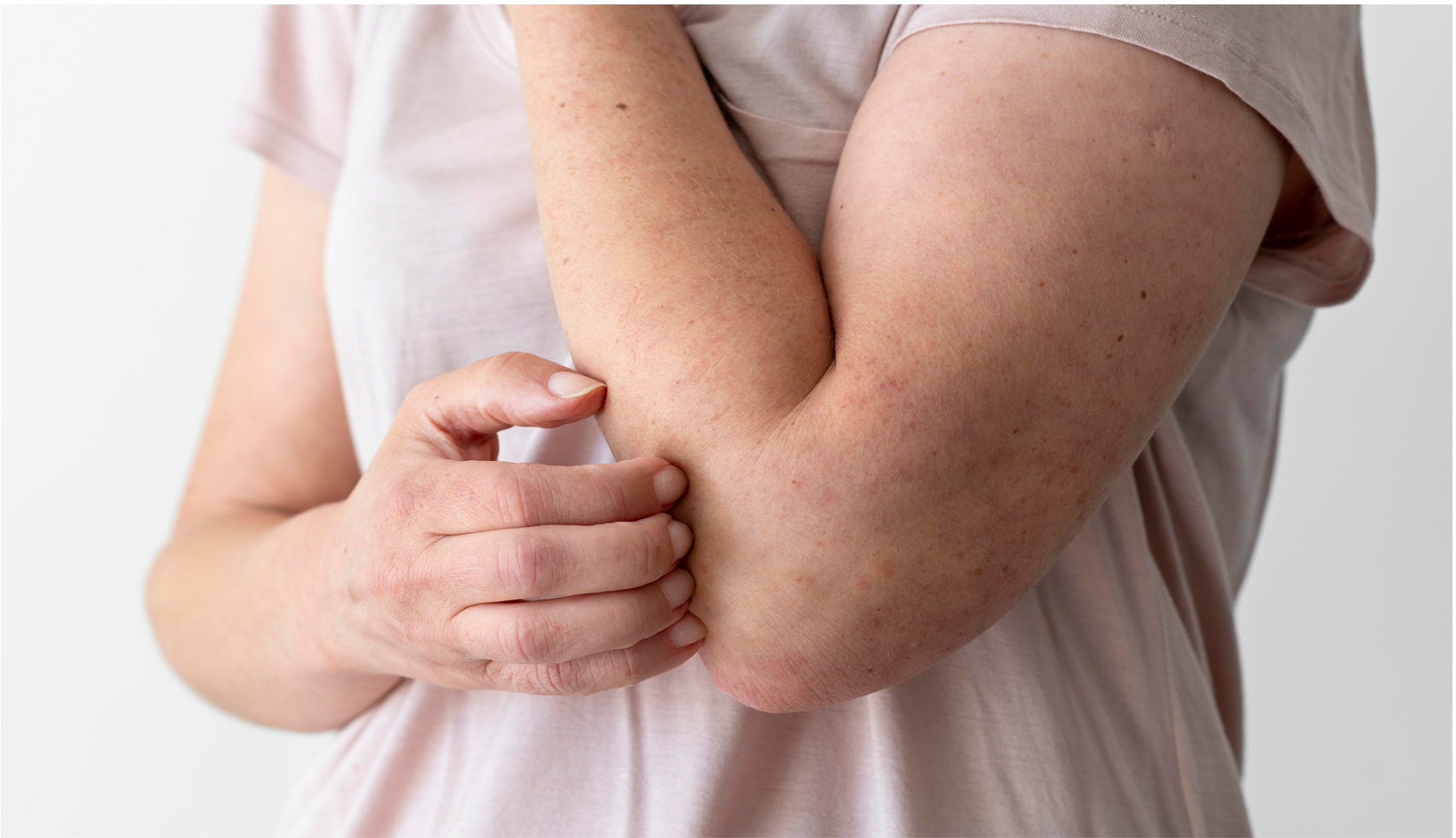 Do egg allergies still matter for vaccination decisions?